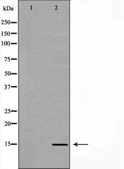 Invitrogen Luteinizing Hormone-beta Polyclonal Antibody 100 &mu;L; Unconjugated:Antibodies,