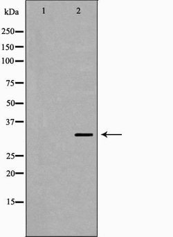 Invitrogen MC2R Polyclonal Antibody 100 &mu;L | Buy Online | Invitrogen&trade; | Fisher Scientific