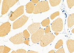 Invitrogen Orexin Receptor 2 Polyclonal Antibody 100 &mu;L; Unconjugated:Antibodies,