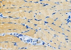 Invitrogen Orexin Receptor 2 Polyclonal Antibody 100 &mu;L; Unconjugated:Antibodies,