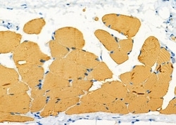Invitrogen Orexin Receptor 2 Polyclonal Antibody 100 &mu;L; Unconjugated:Antibodies,