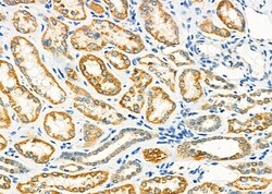 Invitrogen PDK4 Polyclonal Antibody 100 &mu;L; Unconjugated:Antibodies,