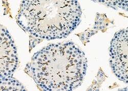 Invitrogen PDK4 Polyclonal Antibody 100 &mu;L; Unconjugated:Antibodies,