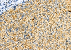 Invitrogen PIWIL2 Polyclonal Antibody 100 &mu;L; Unconjugated:Antibodies,
