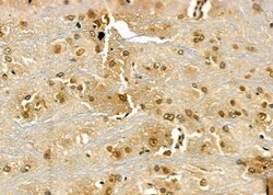 Invitrogen Rad52 Polyclonal Antibody 100 &mu;L; Unconjugated:Antibodies,