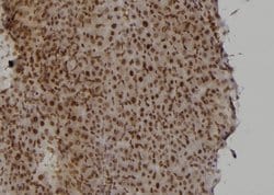 Invitrogen Rad52 Polyclonal Antibody 100 &mu;L; Unconjugated:Antibodies,