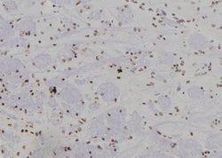 Invitrogen SUMO4 Polyclonal Antibody 100 μL; Unconjugated:Antibodies,