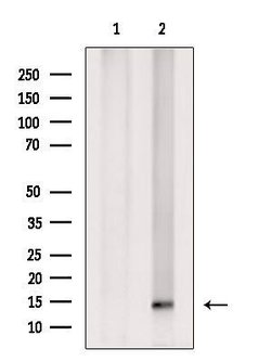 Invitrogen SUMO4 Polyclonal Antibody 100 μL; Unconjugated:Antibodies,