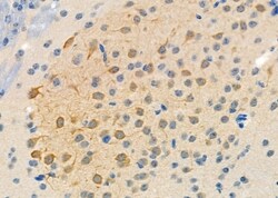 Invitrogen MYSM1 Polyclonal Antibody 100 &mu;L; Unconjugated:Antibodies,