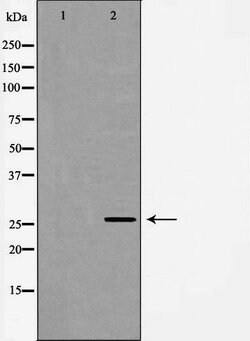 Invitrogen Neurogenin 1 Polyclonal Antibody 100 &mu;L; Unconjugated:Antibodies,