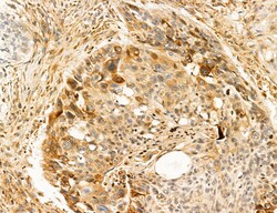Invitrogen SLC22A8 Polyclonal Antibody 100 &mu;L; Unconjugated:Antibodies,