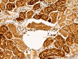Invitrogen SLC22A8 Polyclonal Antibody 100 &mu;L; Unconjugated:Antibodies,