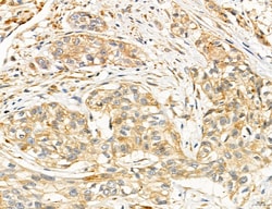 Invitrogen SLC22A8 Polyclonal Antibody 100 &mu;L; Unconjugated:Antibodies,