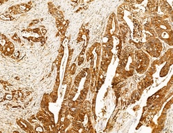 Invitrogen SLC22A8 Polyclonal Antibody 100 &mu;L; Unconjugated:Antibodies,