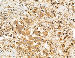 Invitrogen SLC22A8 Polyclonal Antibody 100 &mu;L; Unconjugated:Antibodies,