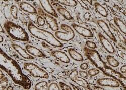 Invitrogen PP2A beta Polyclonal Antibody 100 &mu;L; Unconjugated:Antibodies,
