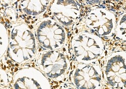 Invitrogen PP2A beta Polyclonal Antibody 100 &mu;L; Unconjugated:Antibodies,