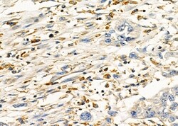 Invitrogen PP2A beta Polyclonal Antibody 100 &mu;L; Unconjugated:Antibodies,