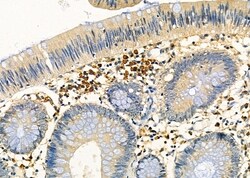 Invitrogen PP2A beta Polyclonal Antibody 100 &mu;L; Unconjugated:Antibodies,