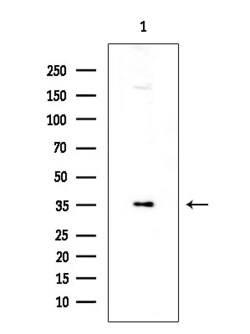 Invitrogen PP2A beta Polyclonal Antibody 100 &mu;L; Unconjugated:Antibodies,