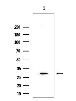 Invitrogen PP2A beta Polyclonal Antibody 100 &mu;L; Unconjugated:Antibodies,