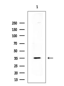 Invitrogen PP2A beta Polyclonal Antibody 100 &mu;L; Unconjugated:Antibodies,