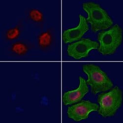Invitrogen NLK Polyclonal Antibody 100 &mu;L; Unconjugated:Antibodies,