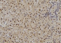 Invitrogen RAI16 Polyclonal Antibody 100 &mu;L; Unconjugated:Antibodies,