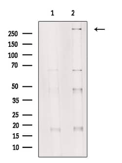 Invitrogen SETD2 Polyclonal Antibody 100 &mu;L; Unconjugated:Antibodies,