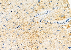 Invitrogen RRM2 Polyclonal Antibody 100 &mu;L | Buy Online | Invitrogen&trade; | Fisher Scientific