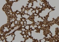 Invitrogen SETD8 Polyclonal Antibody 100 &mu;L; Unconjugated:Antibodies,