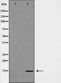 Invitrogen H3K14me3 Polyclonal Antibody 100 &mu;L; Unconjugated:Antibodies,