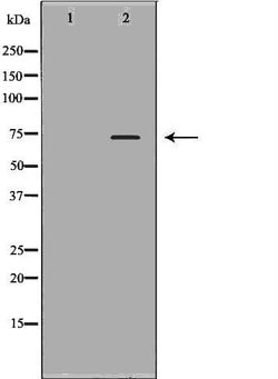 Plasma Kallikrein Polyclonal Antibody:Antibodies, Polyclonal