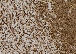 Invitrogen NDRG2 Polyclonal Antibody 100 &mu;L; Unconjugated:Antibodies,