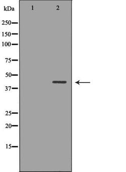Invitrogen NDRG2 Polyclonal Antibody 100 &mu;L; Unconjugated:Antibodies,