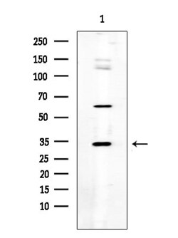 Invitrogen SGCE Polyclonal Antibody 100 &mu;L; Unconjugated:Antibodies,
