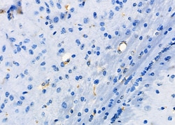 Invitrogen UTS2 Polyclonal Antibody 100 &mu;L; Unconjugated:Antibodies,