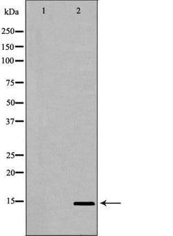 Invitrogen UTS2 Polyclonal Antibody 100 &mu;L; Unconjugated:Antibodies,