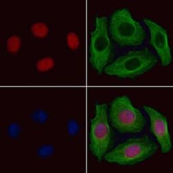 GTF2A1 Polyclonal Antibody 100 &mu;L | Buy Online | Thermo Scientific | Fisher Scientific
