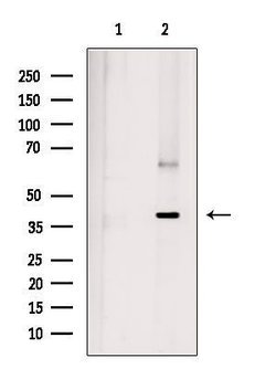 GTF2A1 Polyclonal Antibody 100 &mu;L | Buy Online | Thermo Scientific | Fisher Scientific