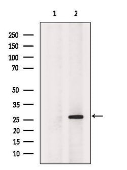 Invitrogen HDGF Polyclonal Antibody 100 &mu;L; Unconjugated:Antibodies,