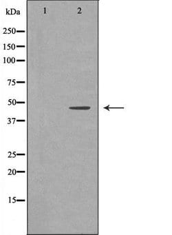 Invitrogen HFE2 Polyclonal Antibody 100 &mu;L | Buy Online | Invitrogen&trade; | Fisher Scientific