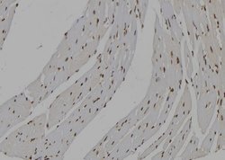 Invitrogen IMPDH2 Polyclonal Antibody 100 &mu;L; Unconjugated:Antibodies,