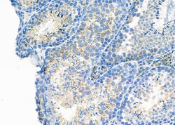 Invitrogen LTBR Polyclonal Antibody 100 &mu;L | Buy Online | Invitrogen&trade; | Fisher Scientific