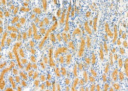 Invitrogen LTBR Polyclonal Antibody 100 &mu;L | Buy Online | Invitrogen&trade; | Fisher Scientific