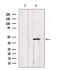 Invitrogen LTBR Polyclonal Antibody 100 &mu;L | Buy Online | Invitrogen&trade; | Fisher Scientific