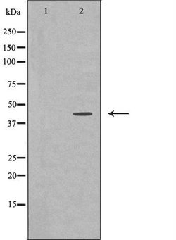 Invitrogen MVK Polyclonal Antibody 100 &mu;L | Buy Online | Invitrogen&trade; | Fisher Scientific