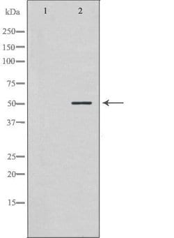 Invitrogen NEK2 Polyclonal Antibody 100 &mu;L; Unconjugated:Antibodies,