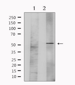 Invitrogen GFR alpha-1 Polyclonal Antibody 100 &mu;L; Unconjugated:Antibodies,