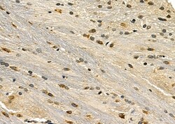 Invitrogen GFR alpha-1 Polyclonal Antibody 100 &mu;L; Unconjugated:Antibodies,